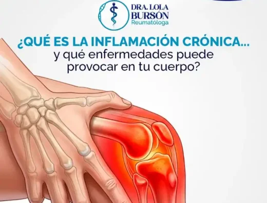 Dra. Lola Bursón | Reumatóloga